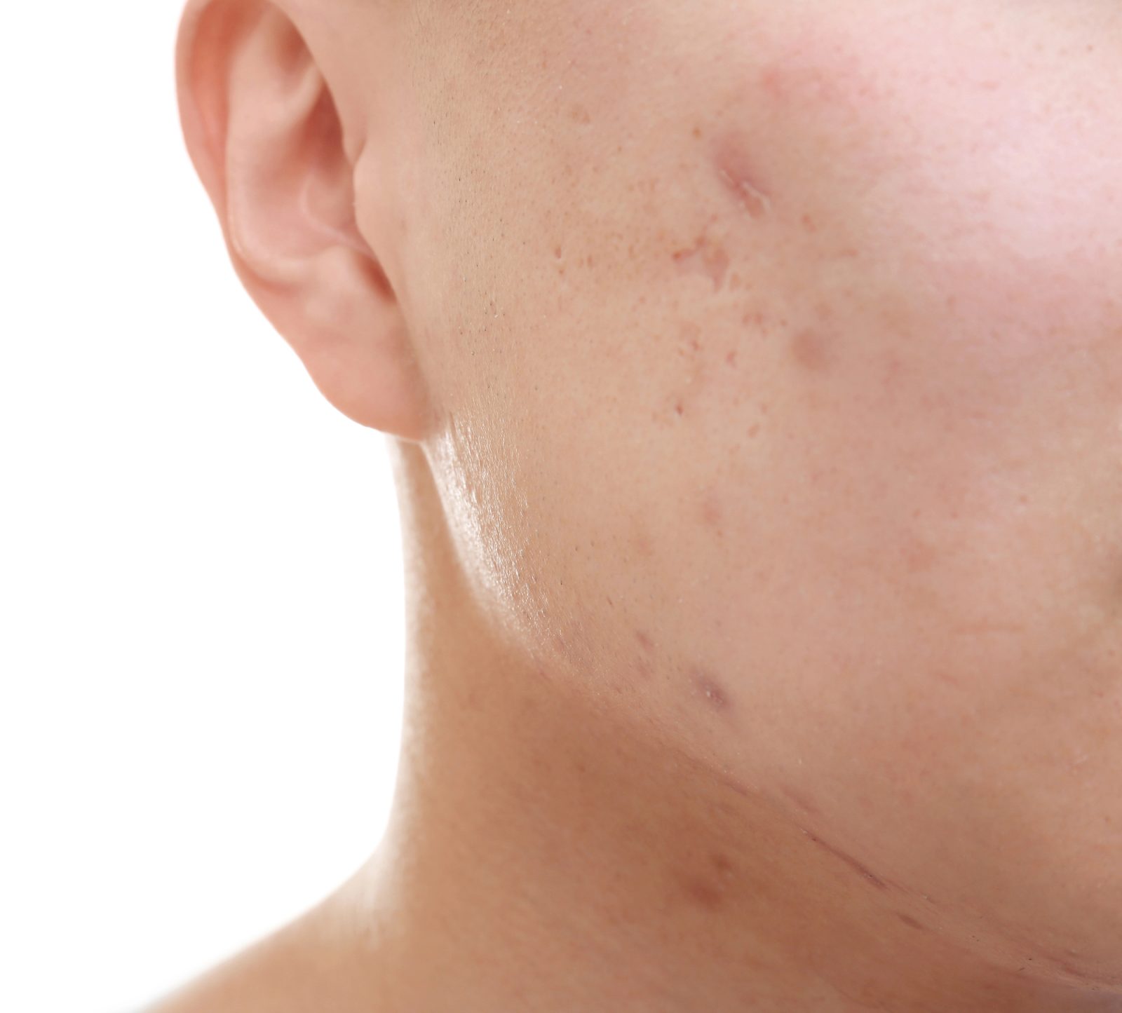 Medicinska veja dermatologija obsega široko medicinsko področje